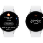 Wearable ECG Monitor