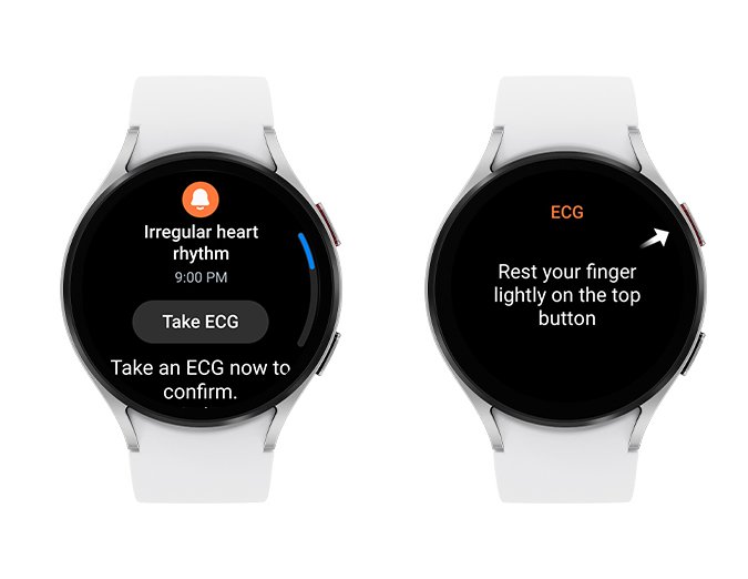 Wearable ECG Monitor