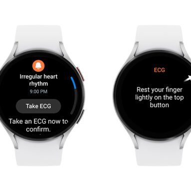 The Pulse of the Future: Wearable ECG Monitor